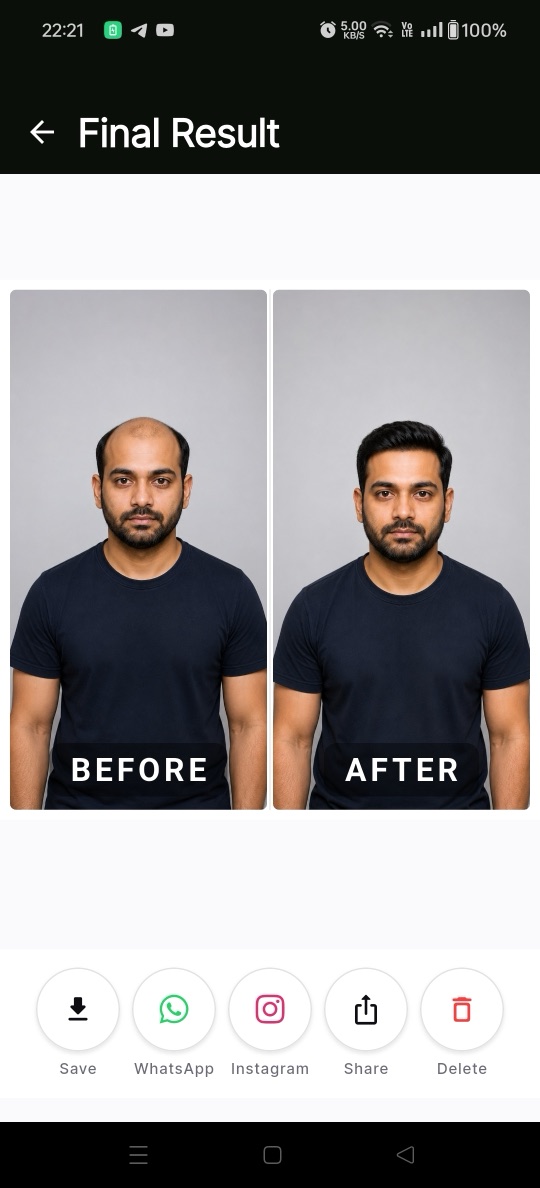 ProgressShot hair transformation before and after result